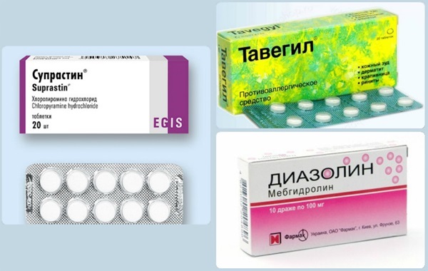 Сонячний опік шкіри